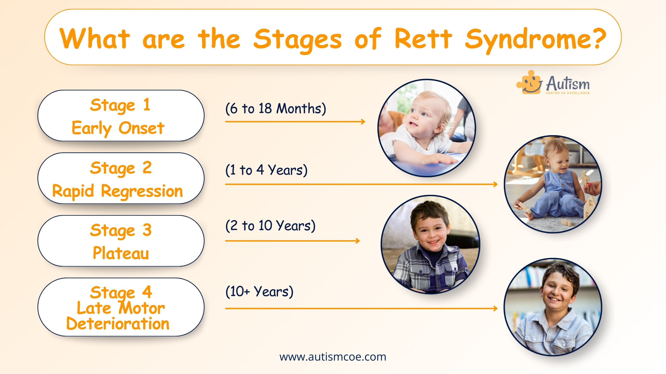 What are the Stages of Rett Syndrome